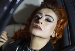 Yüzünde kimyasal yanık oluşmuştu! Yıldız Tilbe son halini paylaştı