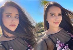 Masterchef Eslem Sena Yurt bıçaklandığını sosyal medyadan açıkladı