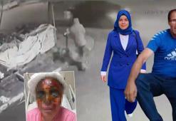 İstanbul'da kezzaplı saldırı şoku! 'Sesimi duyun, gözlerimden kan geliyor'