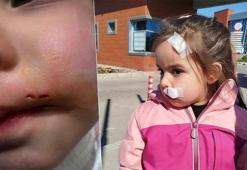 İzmir'de korku dolu anlar! Sahipsiz köpek 3 yaşındaki Elif'e saldırdı