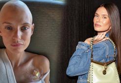 Kansere yakalandığını duyurmuştu! Victoria's Secret meleği Bianca Balti'nin son hali ortaya çıktı