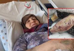 7 sahipsiz köpek 66 yaşındaki kadına dehşeti yaşattı!