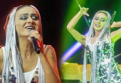 Saç boyası yüzünü yakmıştı! Yıldız Tilbe son durumunu açıkladı