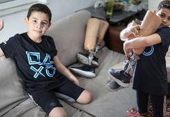 Aras'ın protez bacaklarına icra gelmişti! Herkesi sevindiren haber