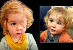 Çocukları öpmeyin! İki yaşındaki çocuğu HSV virüsü kör etti