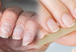 Elleri pamuk gibi yapıyor! Soğuktan çatladıysa hemen sürün, birebir etki