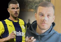 Fenerbahçe'de Edin Dzeko'dan alkışlanan hareket!