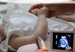 SMA'ya karşı tarihi adım! Anne karnında ilaçla tedavi: '30 ay sonra bile belirti yok'