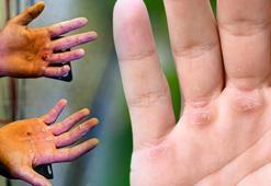 Ellerdeki nasırlara birebir! Pamuk gibi yapıp yumuşatıyor