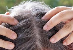 Gri saçları siyaha çeviren asırlık formül! Sadece 2 malzemeyle çaresi var