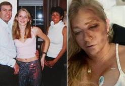 Prensi cinsel istismarla suçlayan Epstein kurbanı kaza geçirdi! '4 gün ömrüm kaldı'