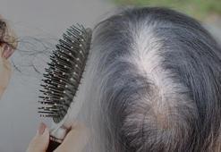 Tarağınıza iyice bakın, 4 işareti var! İhmal edilirse kel kalabilirsiniz