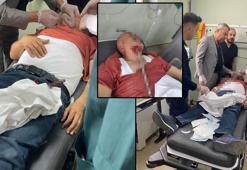 Hatay'da feci olay! İnşaat işçisinin yüzüne demir saplandı