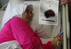 Yuttuğu kuruyemiş akciğerini çürüttü: Bir daha yemem