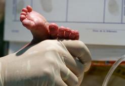 Yenidoğanlarda güvenli ve etkili bir yöntem! 12 aylığa kadar kullanılabilir