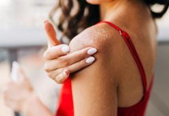 Güneş alerjisinden korunmak mümkün! İltihabı azaltan yöntem