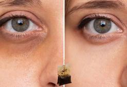 Göz altı halkaları tarih olacak! Pahalı kremler çöpe, doğal iksir poşetin içinde