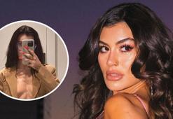 Kısmetse Olur programıyla tanınmıştı! Cansel Çördük'ün son hali şaşırttı