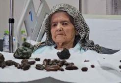 Karın ağrısı sandı, meğer taşmış! Hurma ile zeytin tek suçlusu: 'Kimse yutmasın'