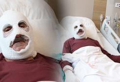 Gaz kaçağını çakmakla kontrol etti, bu hale geldi: O durumda hiç acı hissetmiyordum