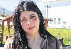 Tacizin bıraktığı yara: Platinler