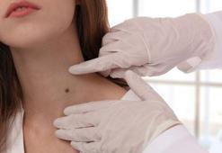 4 yıl umursamadı, kanser çıktı! İlk işareti nokta gibi: 'Kolumun bir kısmı alındı'