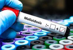 Avustralya'da melioidoz salgını! Can kaybı 31'e çıktı