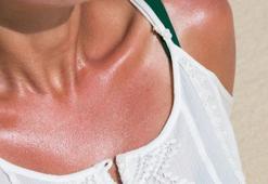 Güneşten kaçış planı başlasın! İşte cildinizi korumak için doğru saatler