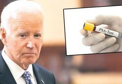 PSA kan testi, prostat kanseri riskini erken haber veriyor: Geç kalınırsa agresif oluyor