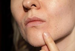 Tatile çıkarken bu hataları yapmayın! Cildi tahriş eden uygulama