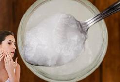 Ağız kenarındaki sivilcelere son! En inatçı akneleri bile yatıştırıyor