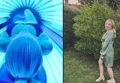 Bronzlaşmak isterken kanser oldu! Solaryum hayatını kararttı