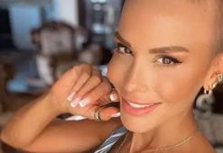 Şimal öldü mü? Şarkıcı Şimal kimdir, kaç yaşındaydı ve hastalığı neydi?