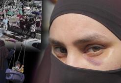 Parka giden kadın çocuklarının önünde darbedildi