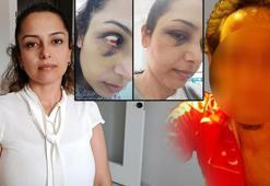 Genç öğretmenin ikinci bahar hayali kabusa döndü! 'Hamileyken dövdü, bebeğimi kaçırdı, aracımı çaldı'