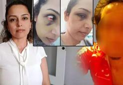 Genç öğretmenin ikinci bahar hayali kabusa döndü!