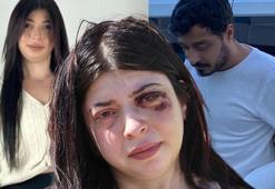 Sokak ortasında taciz edip döndü, 12 suç kaydı ortaya çıktı! Şok karar