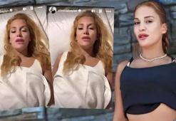 Survivor Almeda Baylan hastanelik oldu! 'Komada iddialarına' ilk açıklama