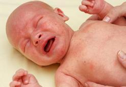 Hapşırma ve öksürmeyle bulaşıyor! Tedavisine hemen başlamak kritik önem taşıyor