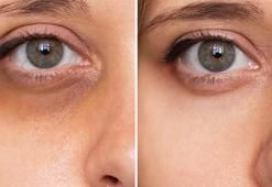 Göz altı morlukları için birebir! Pahalı kozmetikler çöpe gidiyor, nem bombası