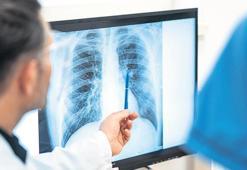 Sigara içmeyen de akciğer kanseri