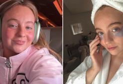 34 yaşında hiç kırışıklığı yok! Bir bant hayatını değiştirdi: 'Botokssuz başardım'