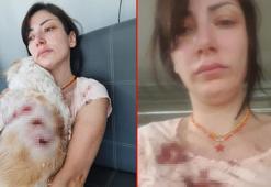 Genç kadın kanlar içinde kaldı! 'Bacağımın arkasını parçaladılar'
