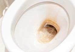 Sararan tuvalet taşını bembeyaz yapıyor! Çamaşır suyundan çok daha etkili