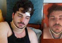 Oyuncu Mehmet Akif Akdeniz trafikteki dehşeti anlattı! 'Her yerim yara içindeydi'