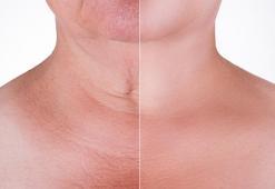 Boyun kırışıkları için daha iyisi yok! Estetiksiz iğnesiz çözüm: Masajla uygulayın