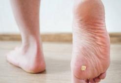 Nasırın kökünü kurutan yağ! Ilık suya damlatıp 10 dakika bekleyin