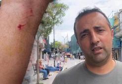 Edirne'de dehşet! 8 köpeğin saldırısına uğradı