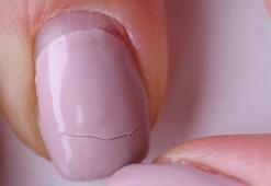 Kırılan tırnaklar yüzünden oje bile sürülmüyor! Dert olmayacak, işte tüyosu