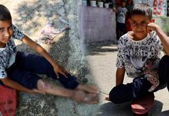 Hayatı 2 yaşındayken karardı, 9 senedir kaykayın üstünde yaşıyor! 'Ayağımın düzelmesini, okula gitmeyi çok isterim'